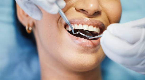 Best Dentist for Tooth Abscess  in Martha Lake, WA